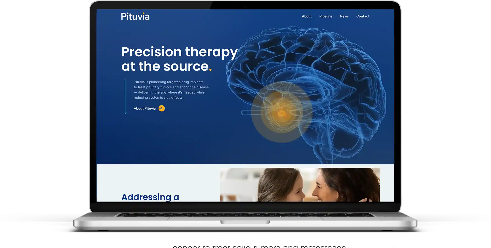 pituvia biotech website san diego CA