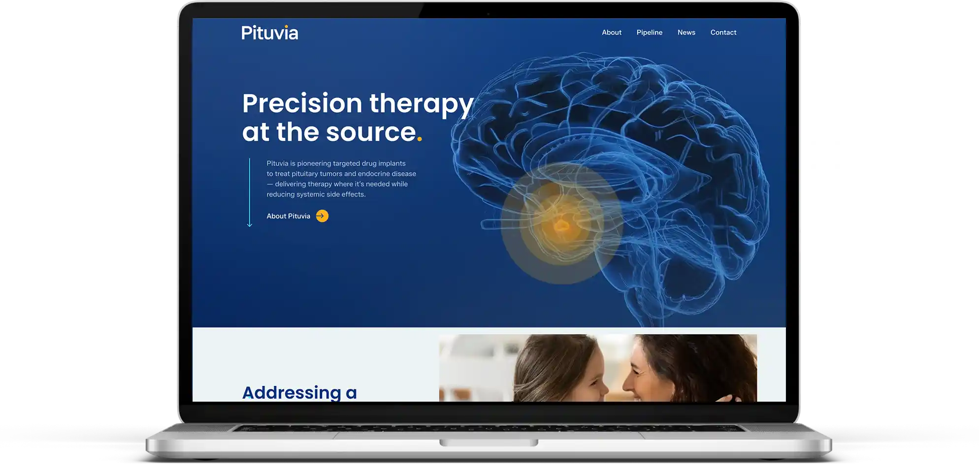 Pituvia is a biotech startup transitioning into the preclinical phase.